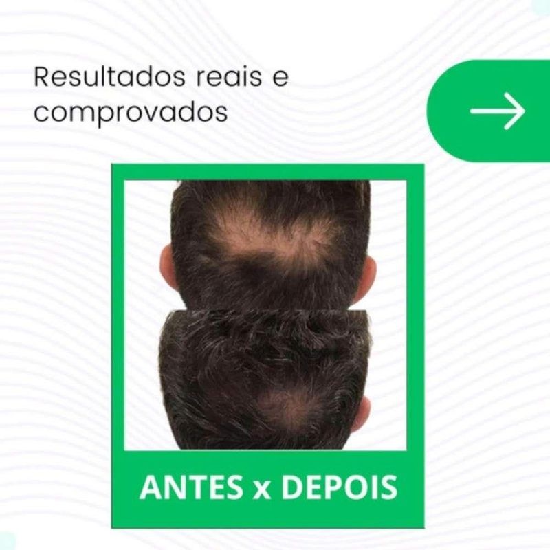 17333442631122