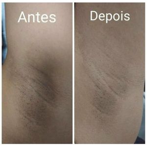 Kit Verão Sem Manchas Micosan 2 sab + 2 pom + Argila Branca