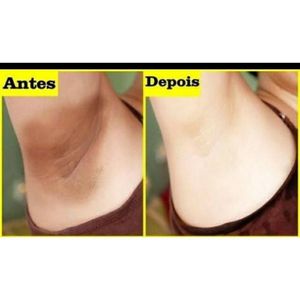 Kit Verão Sem Manchas Micosan + Argila Branca